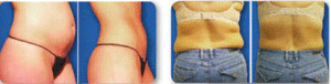 Cosmetic procedures