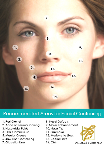 Dermal fillers Dermal Fillers