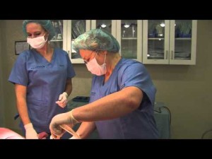 Lipedema Treatment