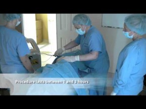 Dr. Marcia Byrd | Atlanta Cellulaze | Cellulite