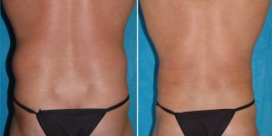 | Atlanta | Before and After Photos | Dr. Marcia Byrd