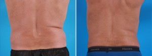 | Atlanta | Before and After Photos | Dr. Marcia Byrd
