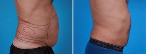 | Atlanta | Before and After Photos | Dr. Marcia Byrd