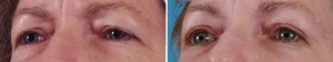 | Atlanta | Before and After Photos | Dr. Marcia Byrd