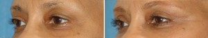 | Atlanta | Before and After Photos | Dr. Marcia Byrd