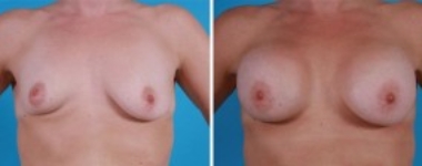 | Atlanta | Before and After Photos | Dr. Marcia Byrd