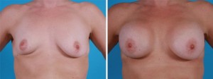 | Atlanta | Before and After Photos | Dr. Marcia Byrd