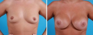 | Atlanta | Before and After Photos | Dr. Marcia Byrd