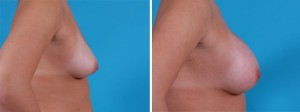 | Atlanta | Before and After Photos | Dr. Marcia Byrd