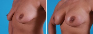 | Atlanta | Before and After Photos | Dr. Marcia Byrd
