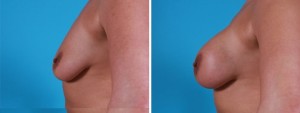 | Atlanta | Before and After Photos | Dr. Marcia Byrd