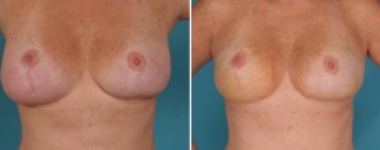 | Atlanta | Before and After Photos | Dr. Marcia Byrd