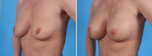 | Atlanta | Before and After Photos | Dr. Marcia Byrd