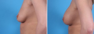 | Atlanta | Before and After Photos | Dr. Marcia Byrd