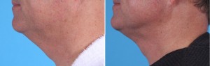 | Atlanta | Before and After Photos | Dr. Marcia Byrd