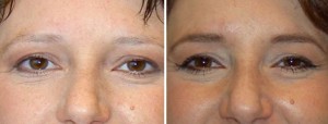 | Atlanta | Before and After Photos | Dr. Marcia Byrd