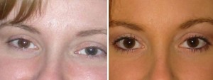| Atlanta | Before and After Photos | Dr. Marcia Byrd