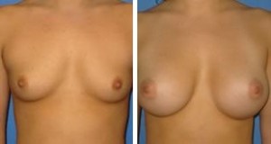 | Atlanta | Before and After Photos | Dr. Marcia Byrd