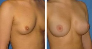 | Atlanta | Before and After Photos | Dr. Marcia Byrd