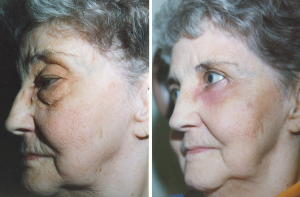 Dr. Lisa Bunin | Allentown, PA