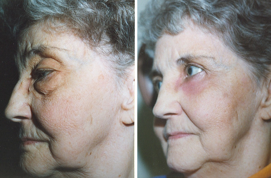 Dr. Lisa Bunin | Allentown, PA