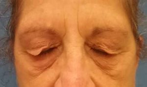 Ophthalmology Services