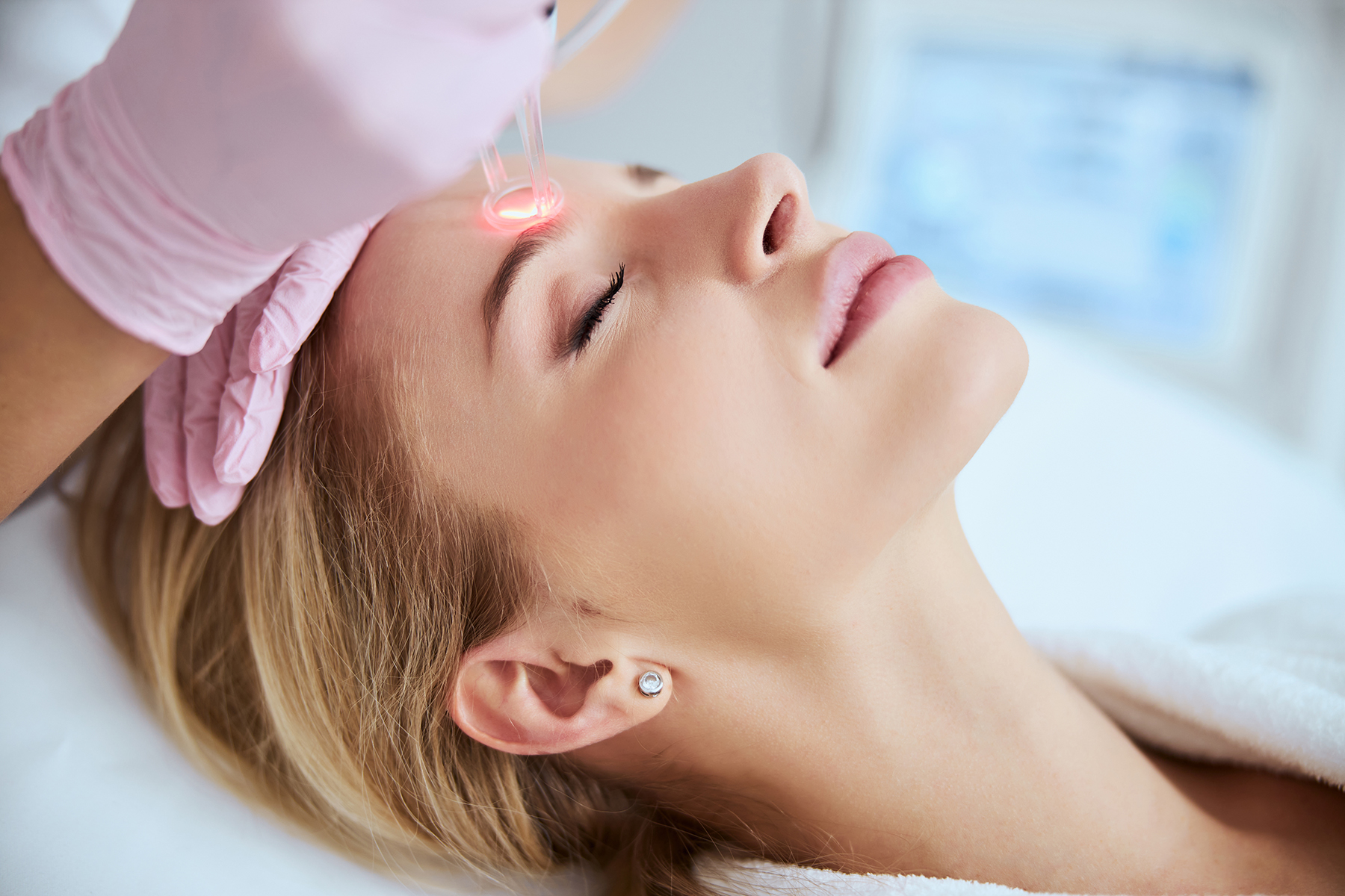 Young patient getting rid of forehead wrinkles CO2Laseer Treatment